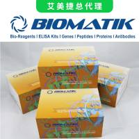 人转钴胺素II，大红细胞性贫血(TCN2)ELISA试剂盒|Human Transcobalamin II, Macrocytic Anemia (TCN2) ELISA Kit