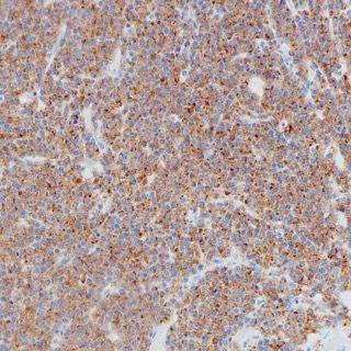 BCMA Recombinant Rabbit mAb