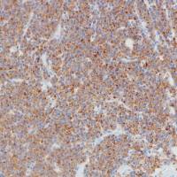 BCMA Recombinant Rabbit mAb