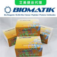 人酰基辅酶A氧化酶1，棕榈酰(ACOX1)ELISA试剂盒|Human Acyl Coenzyme A Oxidase 1, Palmitoyl (ACOX1) ELISA Kit