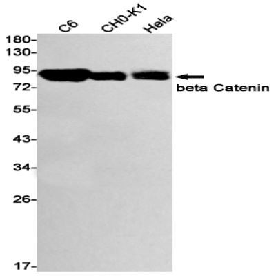 beta Catenin Recombinant Rabbit mAb