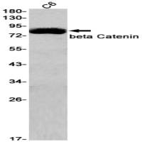 beta Catenin (DGR12883) Rabbit mAb
