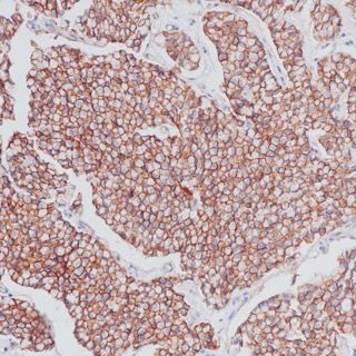 Beta-Catenin Recombinant Rabbit mAb