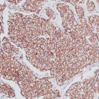 Beta-Catenin Recombinant Rabbit mAb