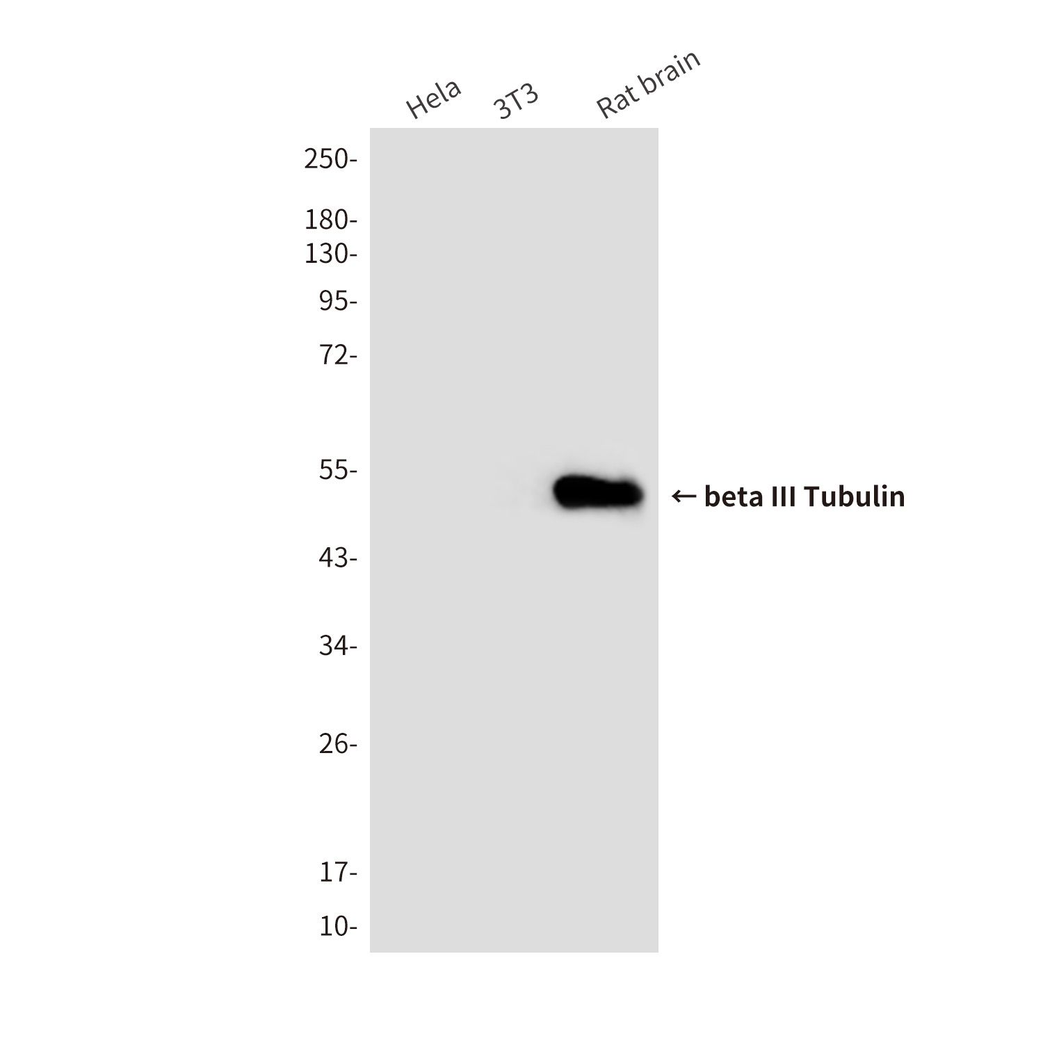 beta III Tubulin (3H2) Mouse mAb
