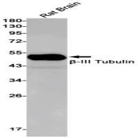 beta III Tubulin Recombinant Rabbit mAb