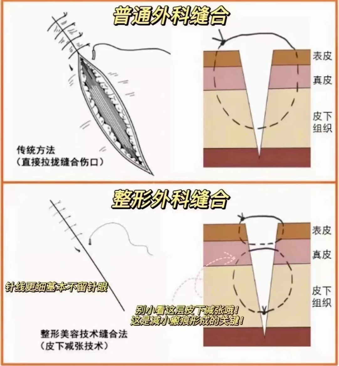 男子被电锯割伤「颜面尽失」,广西壮族自治区南溪山医院医生美容缝合