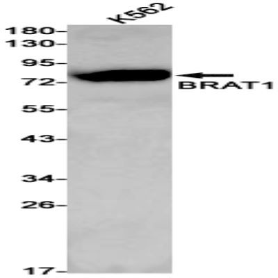 BRAT1 Recombinant Rabbit mAb