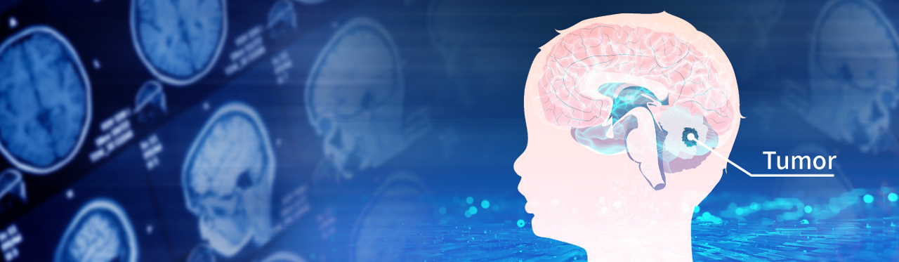 由肿瘤微环境寻找髓母细胞瘤潜力新疗法-C3a受体与TNF-α受体拮抗剂