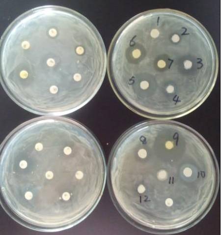 药敏试验方法及操作规程!