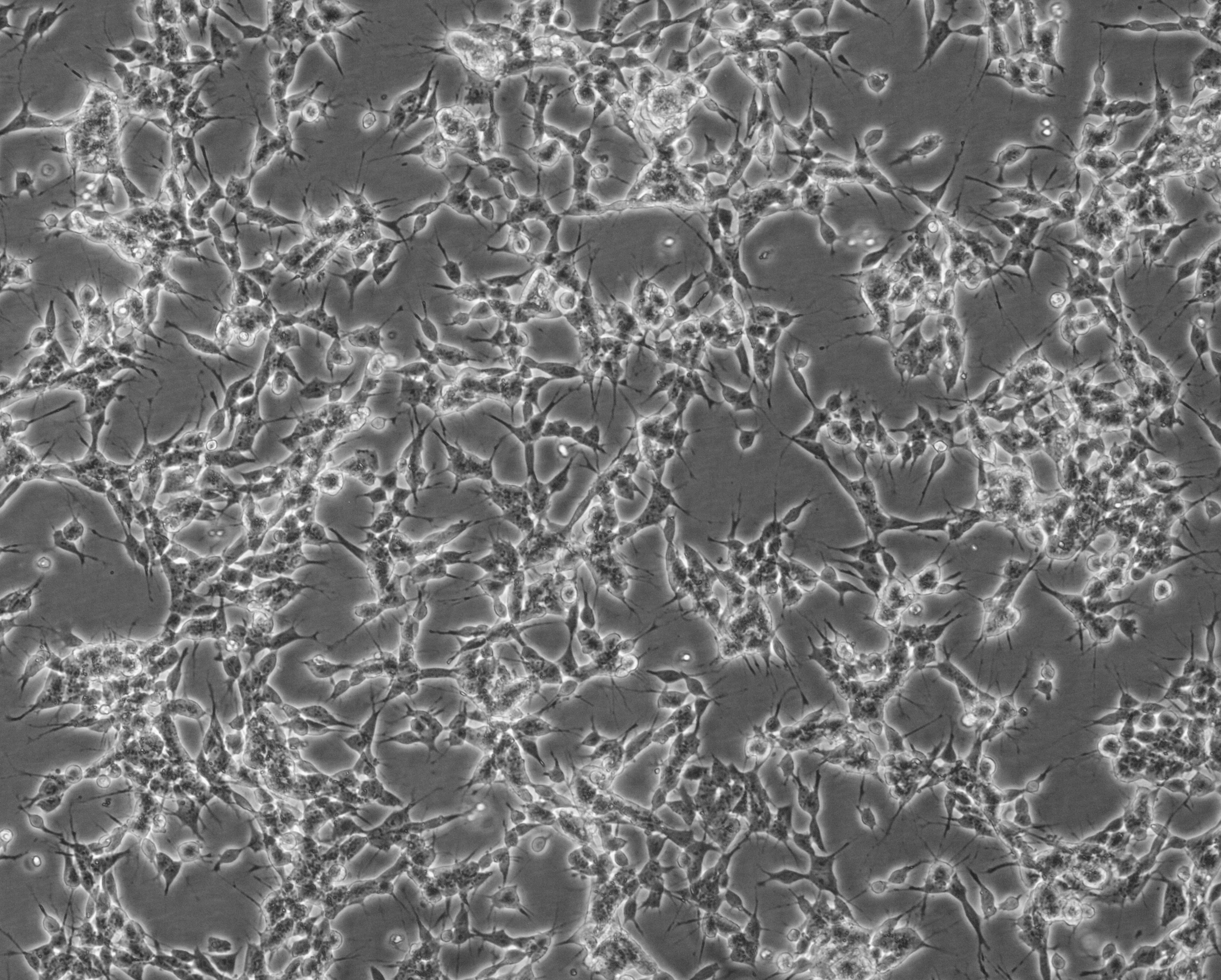 细胞攻略 | SH-SY5Y(人神经母细胞瘤细胞)细胞培养教程