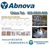 AAK1多克隆抗体|AAK1 polyclonal antibody