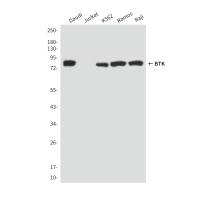 BTK (5B12) Mouse mAb