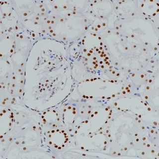 BRG1 Recombinant Rabbit mAb
