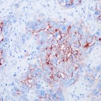 CA125 Recombinant Rabbit mAb
