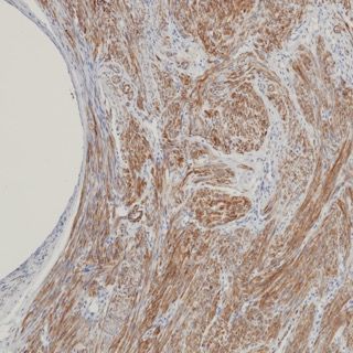 Caldesmon Recombinant Mouse mAb