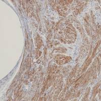 Caldesmon Recombinant Mouse mAb