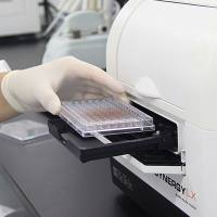 siRNA敲减-WB验证