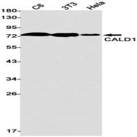 Caldesmon (DGR16346) Rabbit mAb