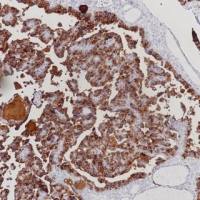 Calcitonin Recombinant Rabbit mAb