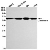 Catalase (DGR14771) Rabbit mAb