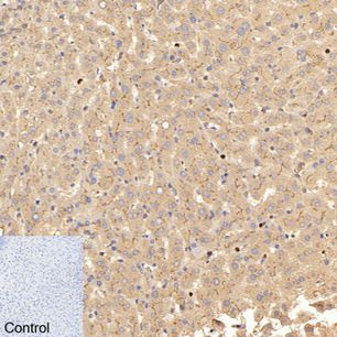 Carcino Embryonic Antigen CEA (2A8) Mouse mAb