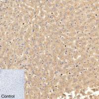 Carcino Embryonic Antigen CEA (2A8) Mouse mAb