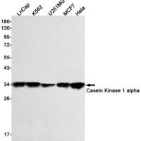 Casein Kinase 1 alpha (DGR14301) Rabbit mAb