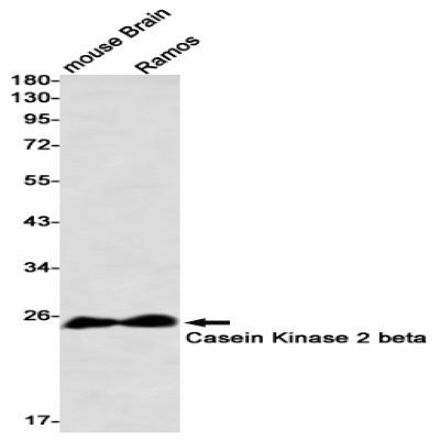 Casein Kinase 2 beta Recombinant Rabbit mAb
