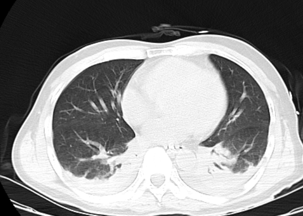 湄潭家礼医院：运用关键技术成功救治农药中毒患者一名