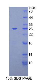 糖抗原125(CA125)重组蛋白(Human，人)
