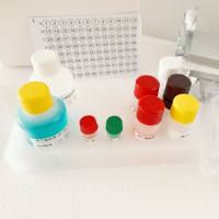 禽脑脊髓炎抗体(AE-Ab)酶联免疫(Elisa)试剂盒