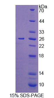 白介素12A(IL12A)重组蛋白(Rat，大鼠)