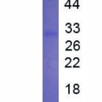 凋亡相关因子配体(FASL)真核蛋白