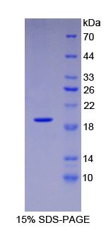 血管内皮生长因子165(VEGF165)重组蛋白 (Human，人)