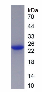 衰老关键蛋白1(FBLN1)重组蛋白(Mouse，小鼠)
