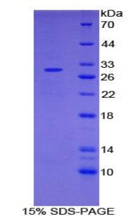 白介素2受体α(IL2Ra)重组蛋白(Mouse，小鼠)