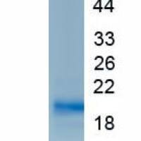 白介素18(IL18)真核蛋白
