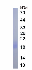 Ig和ITIM域蛋白T-细胞免疫受体(TIGIT)真核蛋白