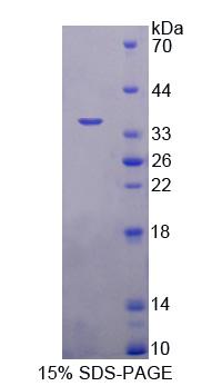 甲基CpG结合域蛋白2(MBD2)重组蛋白