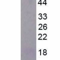 巨噬细胞炎性蛋白1α(MIP1a)真核蛋白