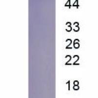 白介素27(IL27)真核蛋白
