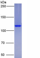 白介素23受体(IL23R)真核蛋白