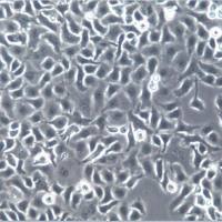 TOV21G细胞、TOV-21G细胞、TOV21G细胞