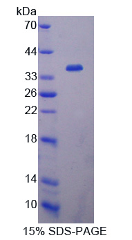 羧肽酶N2(CPN2)重组蛋白