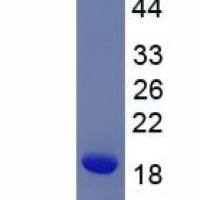 跨膜4域亚家族A成员1(CD20)真核蛋白