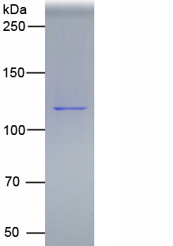 唾液酸结合Ig样凝集素2(CD22)真核蛋白
