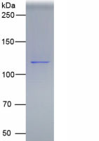 唾液酸结合Ig样凝集素2(CD22)真核蛋白