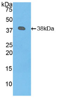 纤溶酶原(Plg)活性蛋白