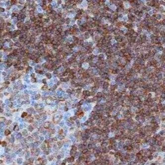 Rabbit Monoclonal Calponin 1 Antibody (CNN1/4227R) [Alexa Fluor?594]